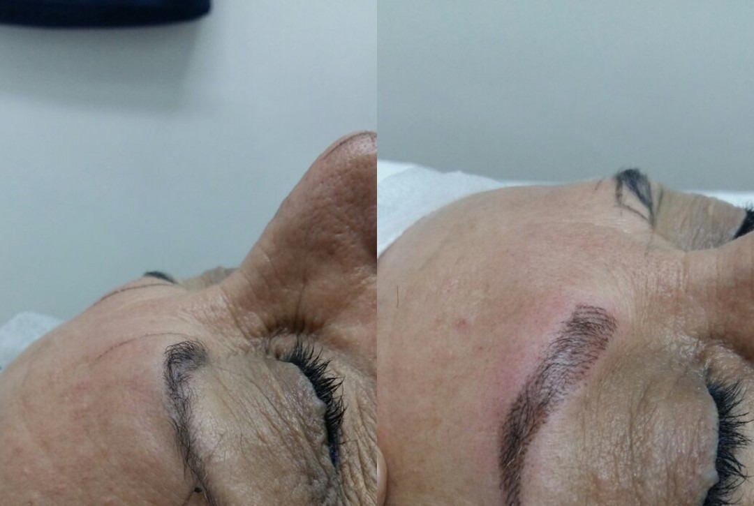 Antes e depois do design de sobrancelhas